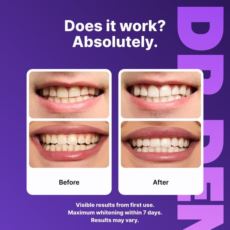DRDENT Purple Teeth Whitening Strips - 7/21 Whitening Sessions - Safe for Enamel - Non Sensitive Teeth Whitening - Peroxide-Free